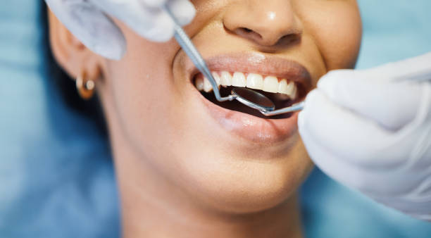Best Cracked Tooth Emergency Dentist  in Rouses Point, NY
